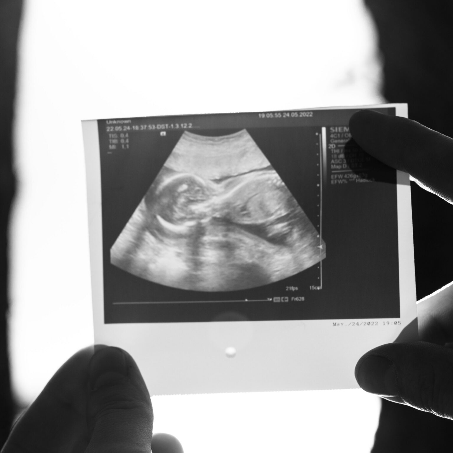 how-to-tell-a-friend-you-re-pregnant-when-they-might-find-it-difficult